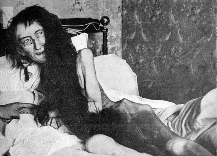 El caso de Blanche Monnier